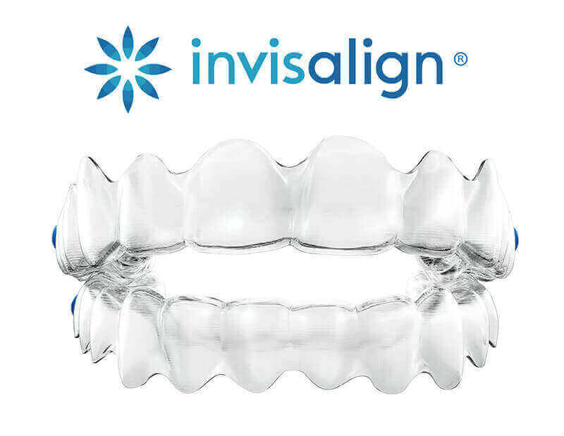 Invisalign Orléans